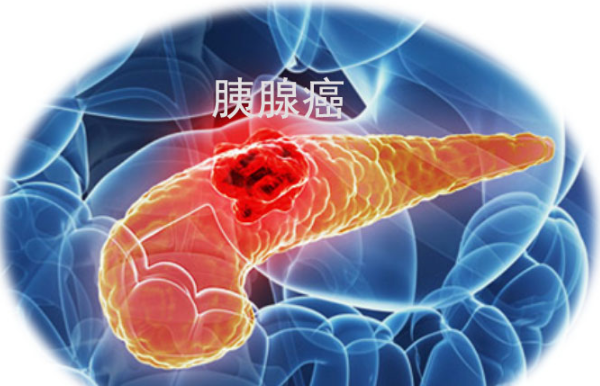 胰腺癌治疗新希望:免疫疗法联合新型KRAS“多靶点”靶向药,这种联合疗法对患者有那些好处? - 知乎