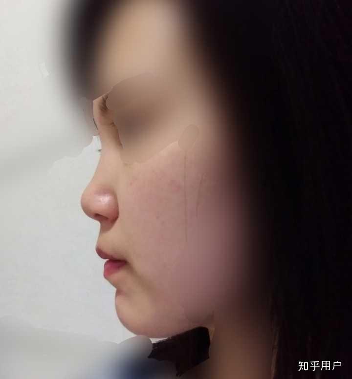 拥有短却挺的鼻子是什么体验