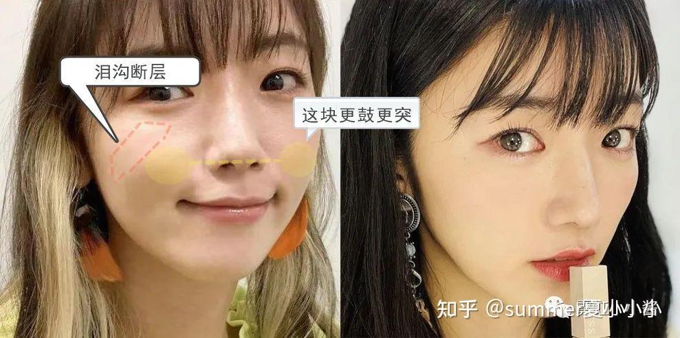 长脸变短、大脸变小、歪脸变正,它才是颜值升级第一站 - 知乎