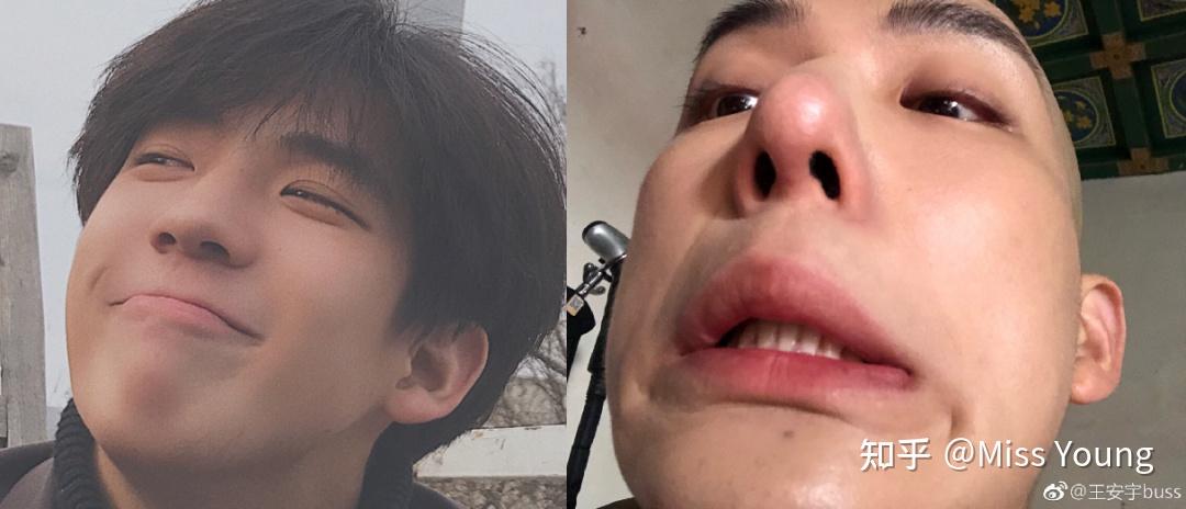 王安宇是不是整容了? - 知乎