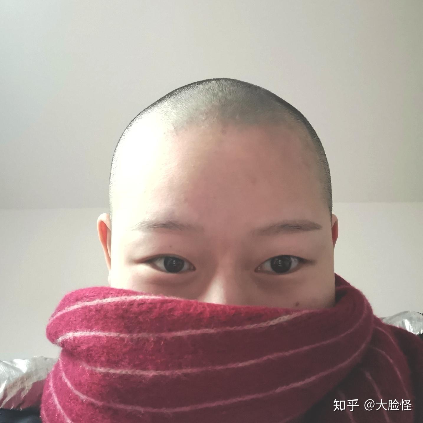 剃光头是否真能改善发质？ - 知乎