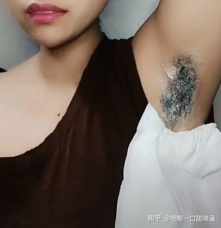 女生腋下汗毛很濃密怎麼去除