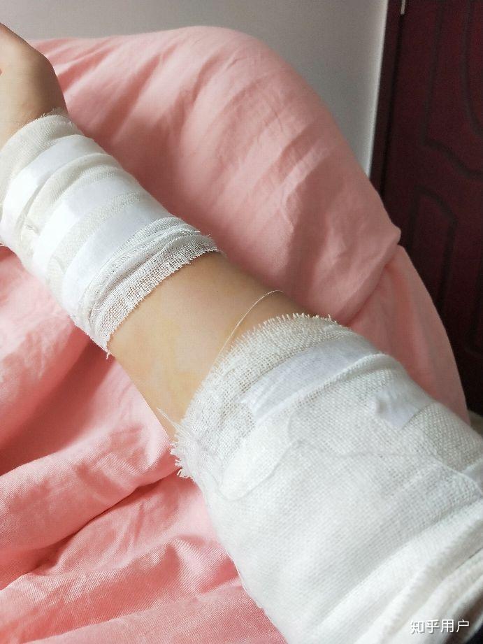 抑郁症患者失恋后会怎样? - 知乎