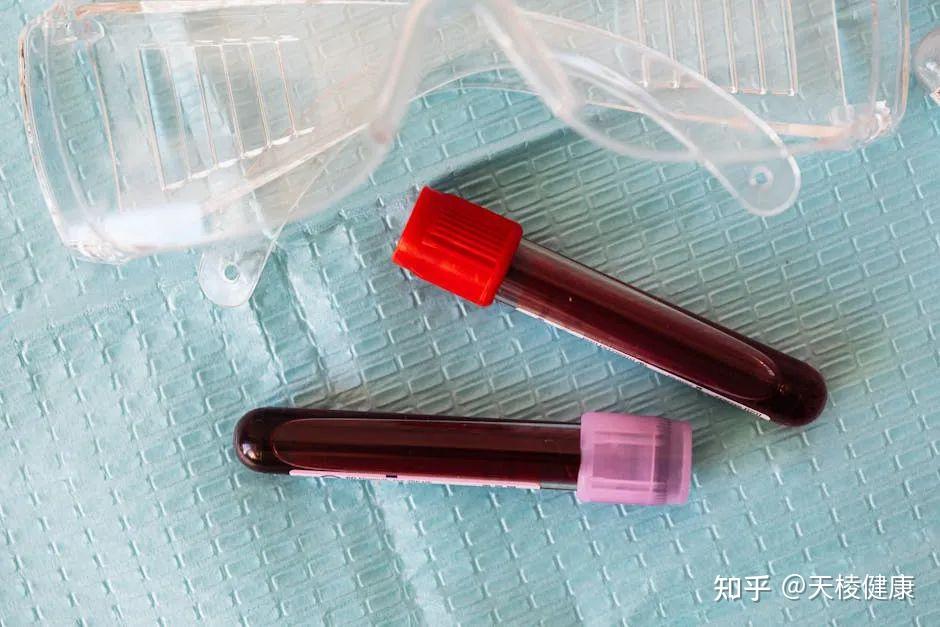 通血管,防脑梗,每天五分钟按一按“化栓穴”,让血管保持畅通! - 知乎