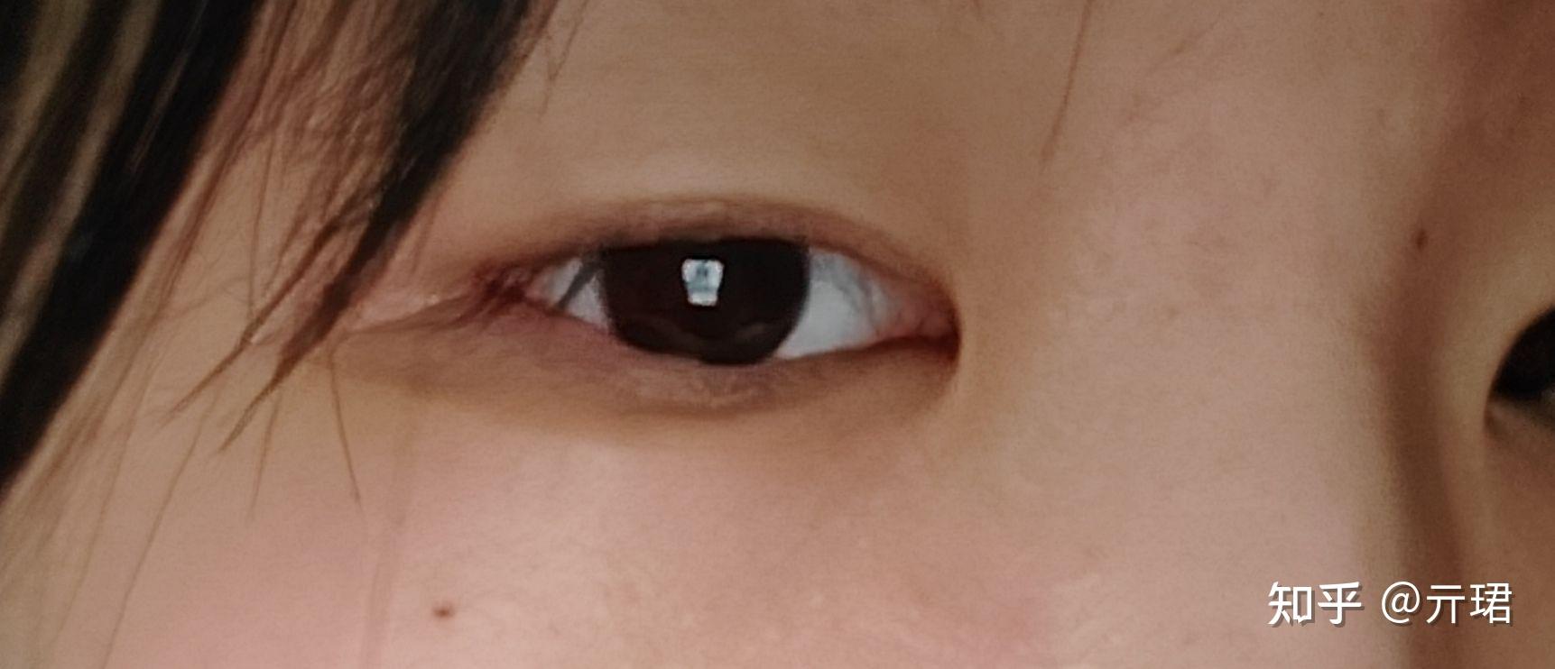 有眼尾沟的眼睛好看吗