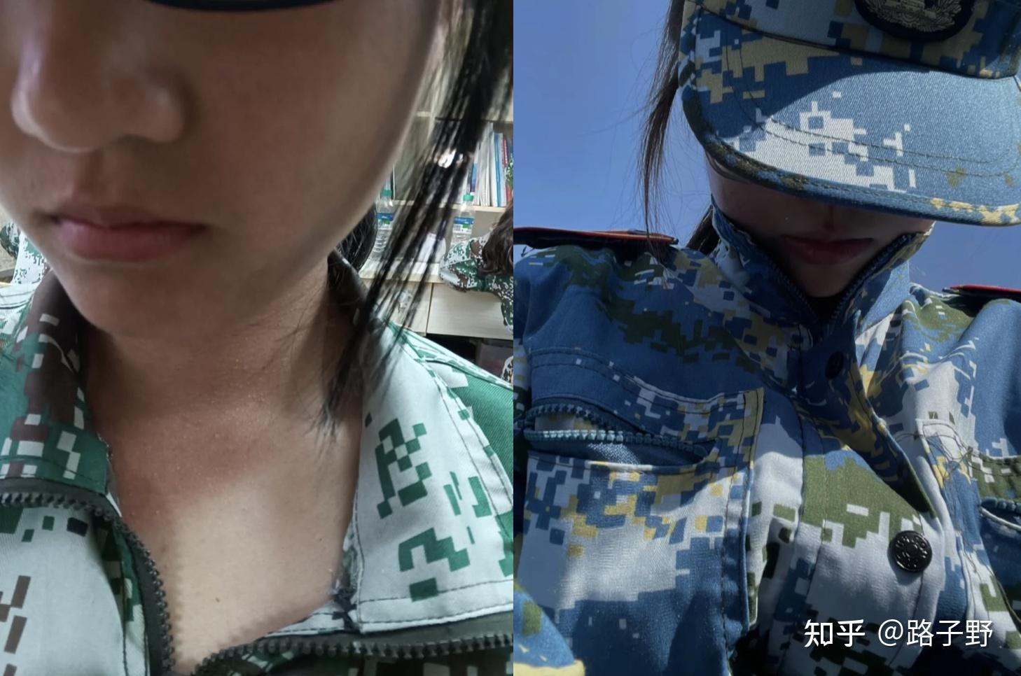 军训如何晒后修复及补水?