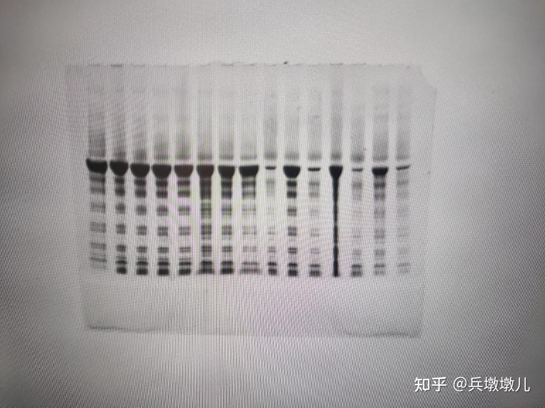 非变性聚丙烯酰胺凝胶电泳10%跑DNA,条带花了是什么原因啊? - 知乎