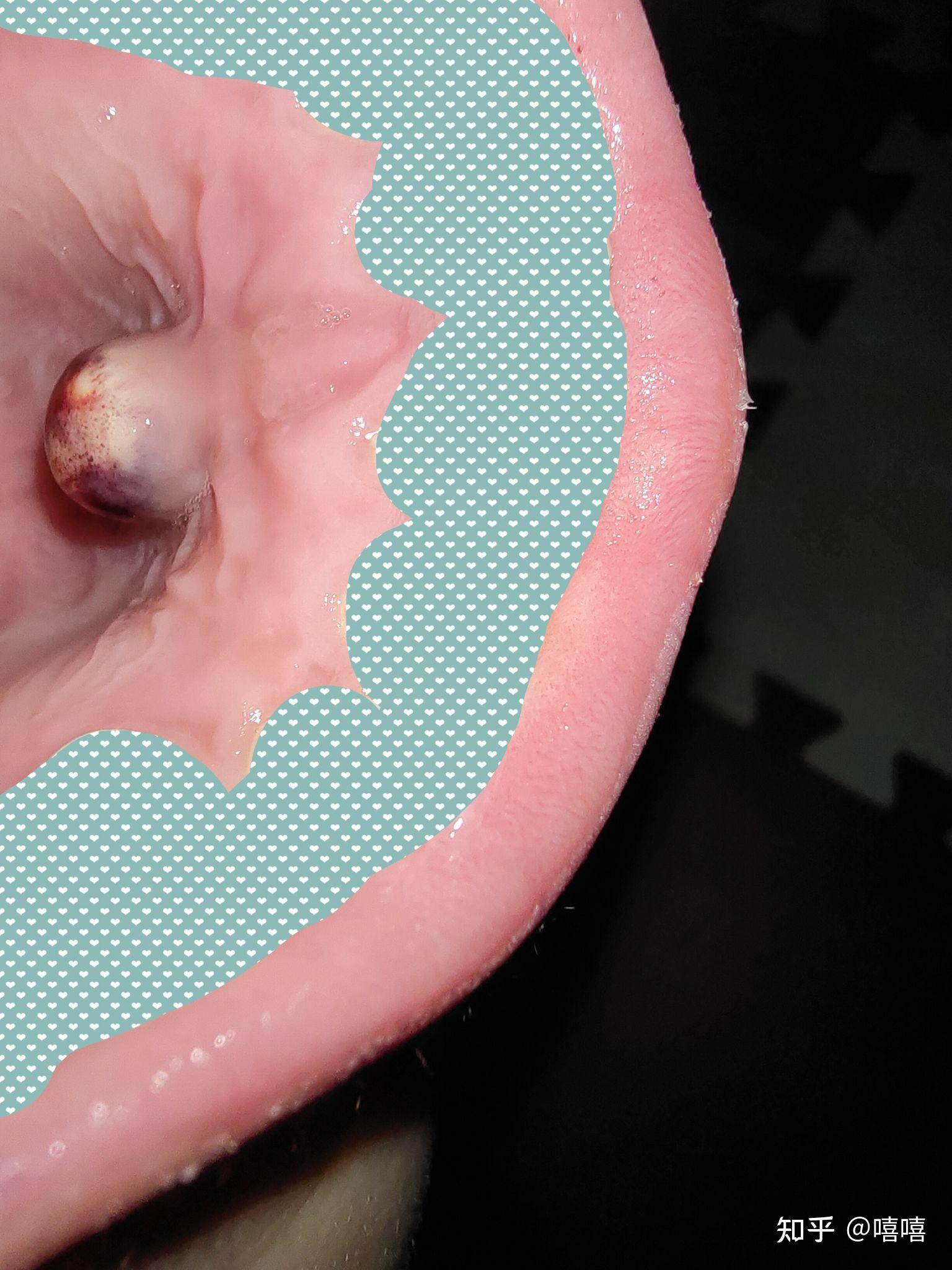 口腔上颚涨了个包医生检查后说有可能是囊肿说拍完ct后再看请问大家