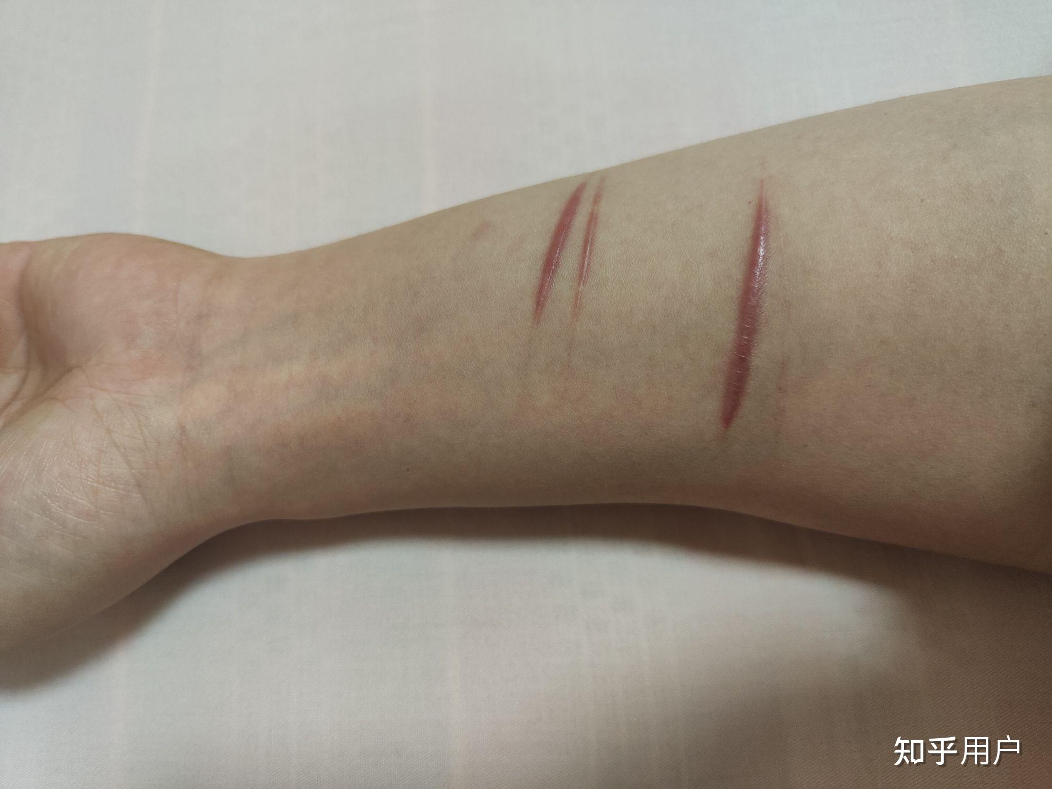 如何向亲人朋友解释自残后的伤口? - 知乎