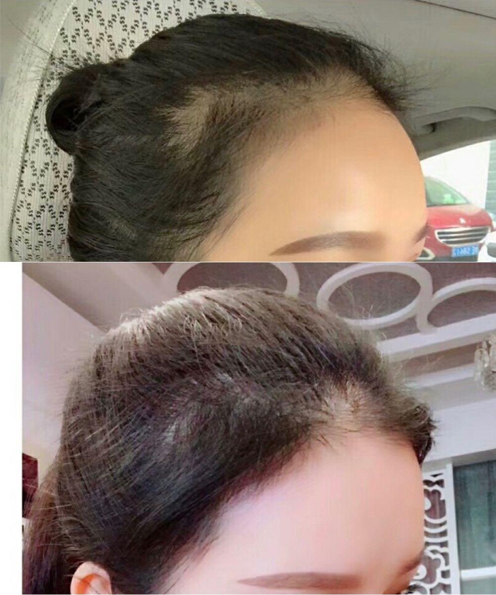 脱发少女大集合各位小仙女有没有妙招