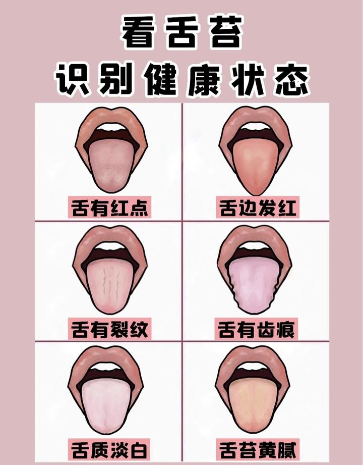 中医教你看舌苔】了解自己的身体状况 - 知乎