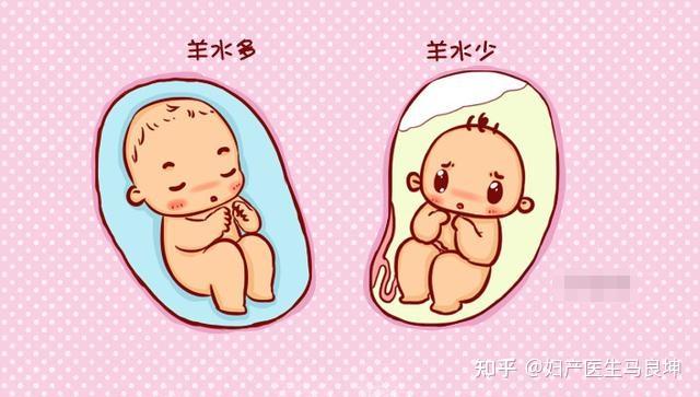 到了这个孕周,胎儿的“胎位”基本固定,以后再等着纠正就难了! - 知乎