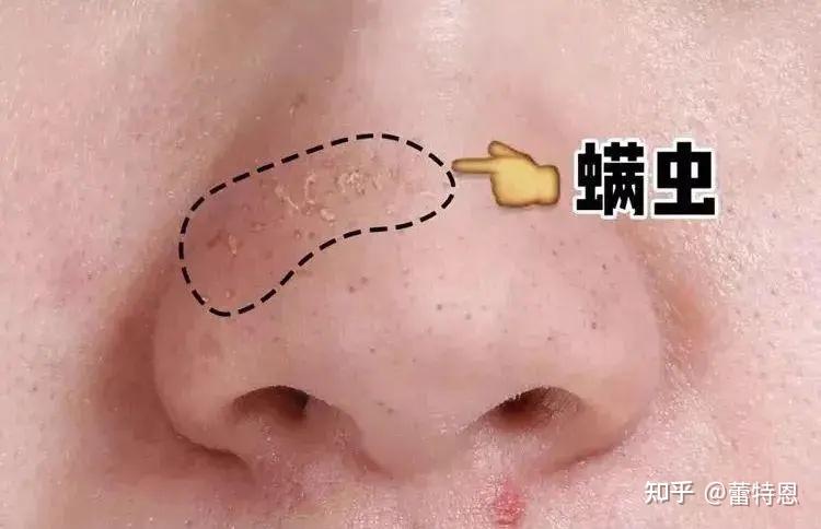 蟎蟲長什麼樣肉眼可以看見嗎