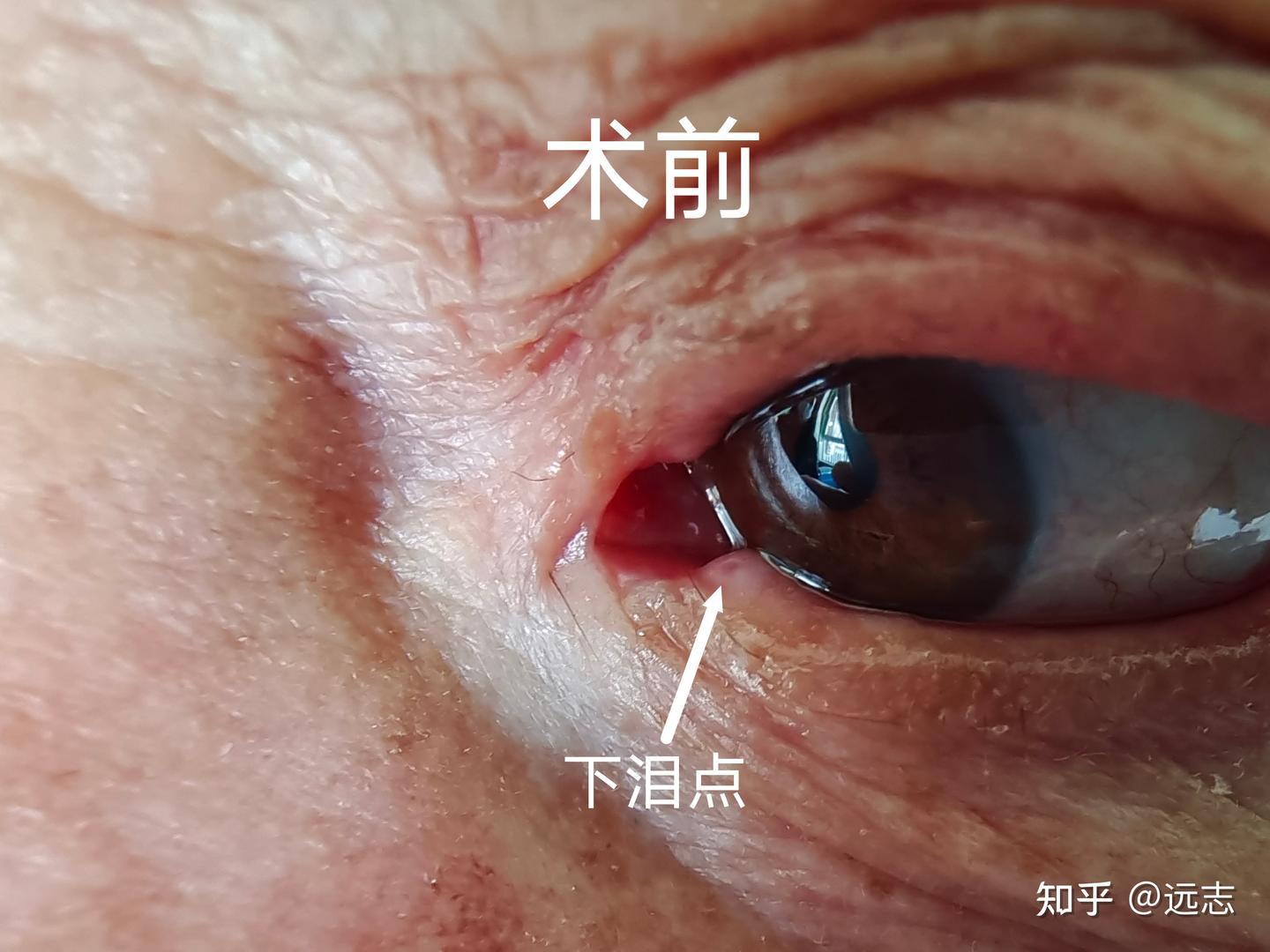 八旬老人溢泪诊治路 - 知乎