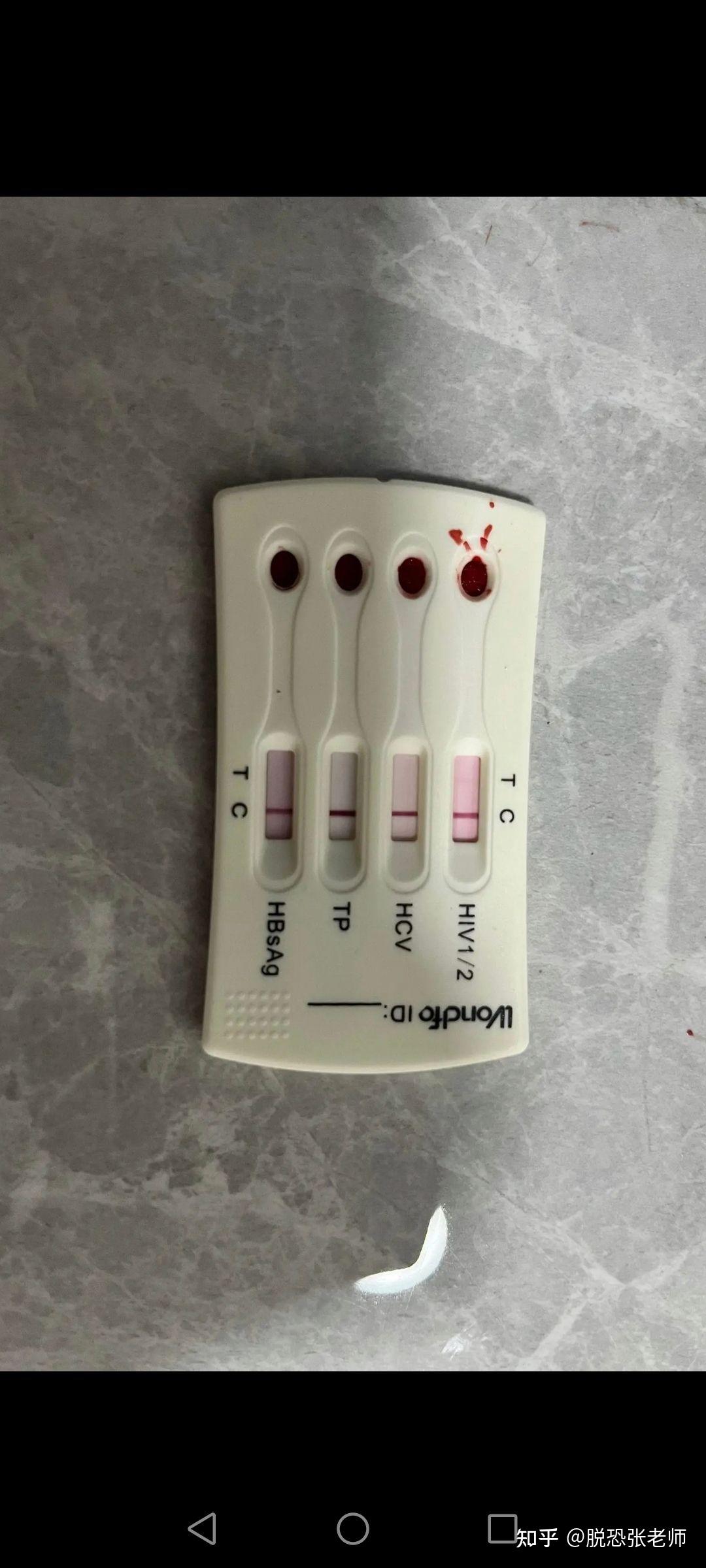 艾滋病试纸假阳性几率大不大?