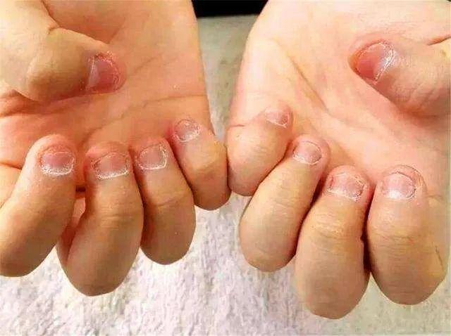小朋友爱咬手指头是什么原因