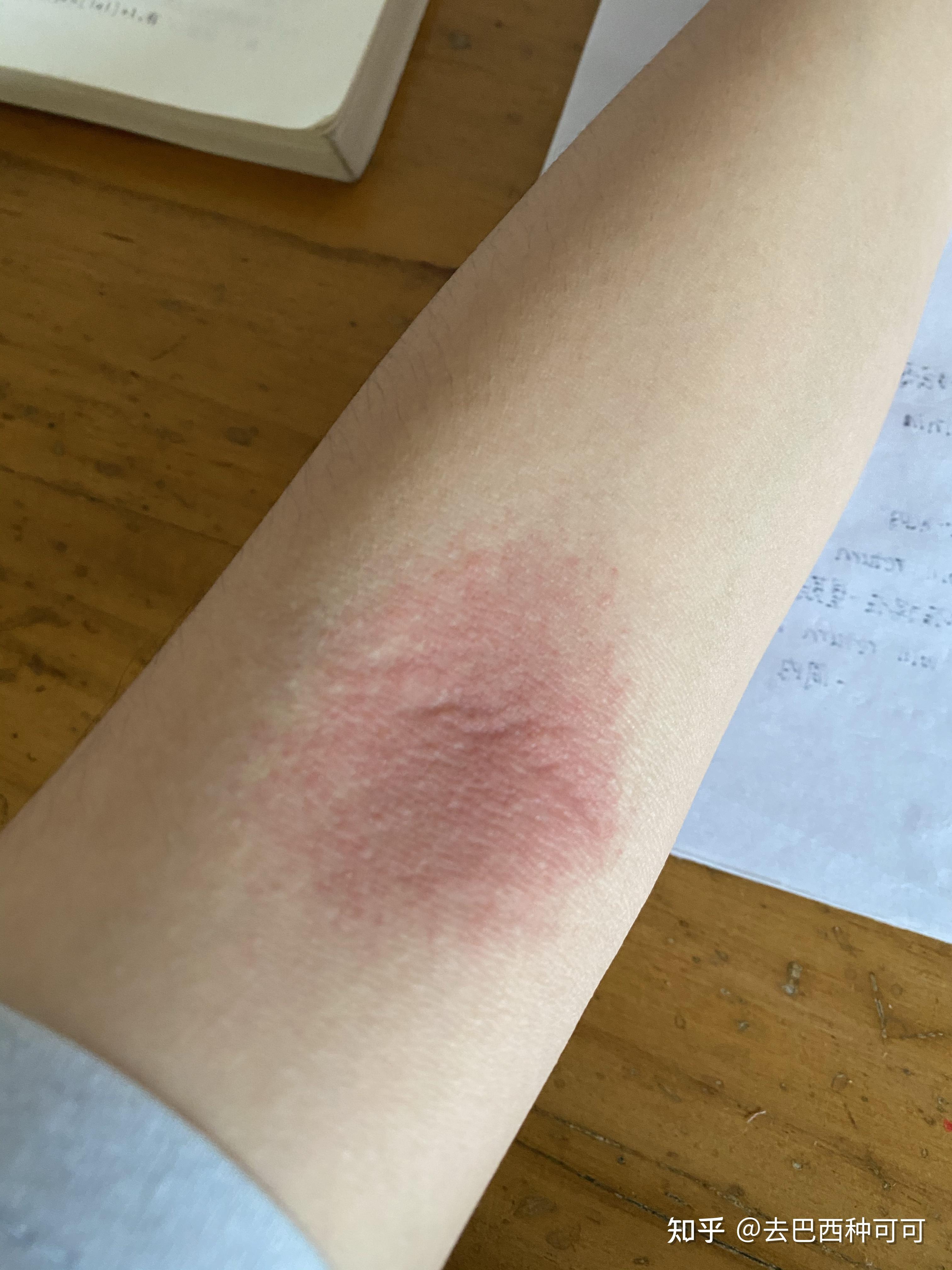 拍打手肘窝真的可以排毒吗? ? - 知乎