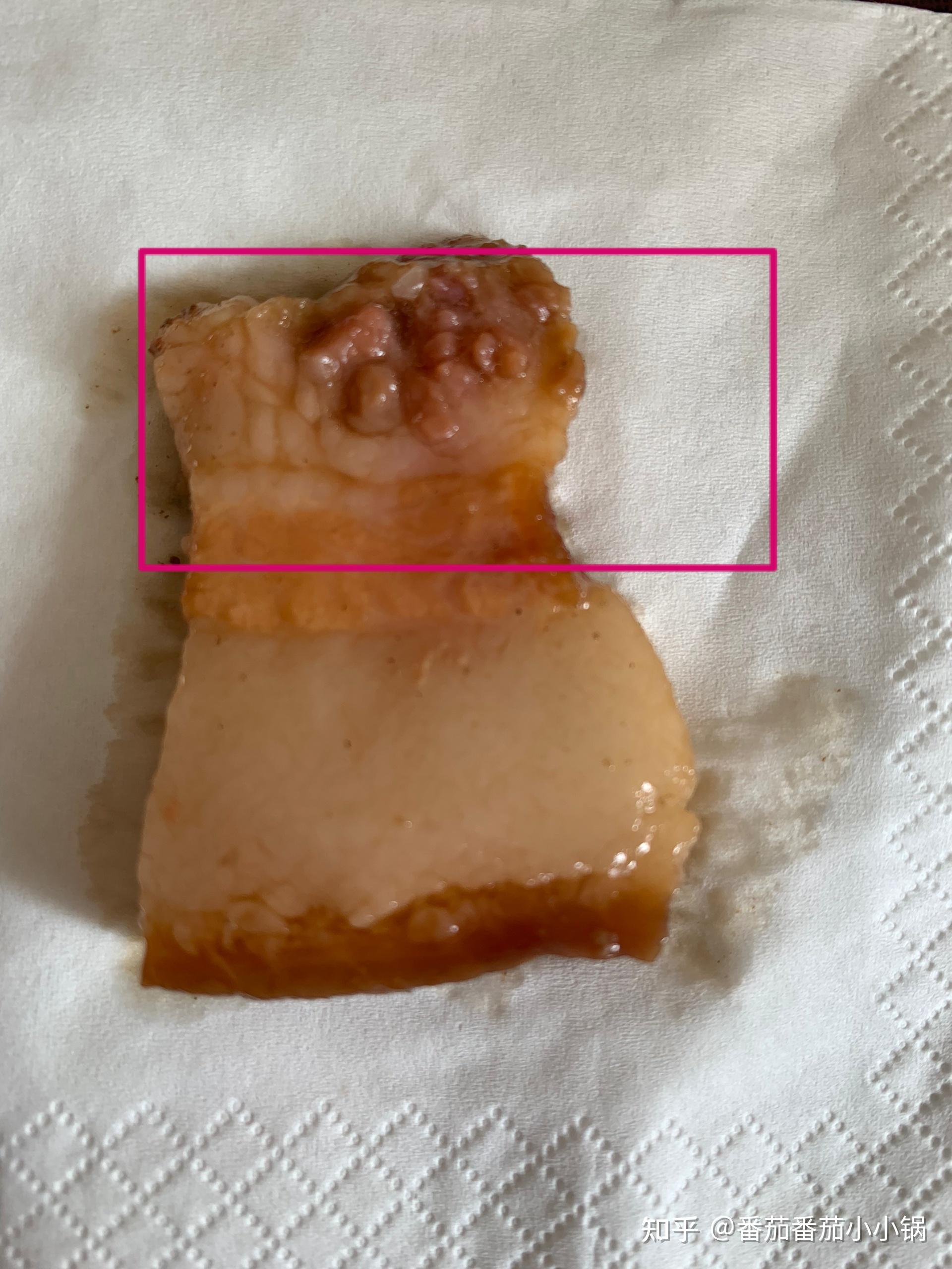 请问这是猪绦虫吗?这是米猪肉吗?还是发霉猪肉?