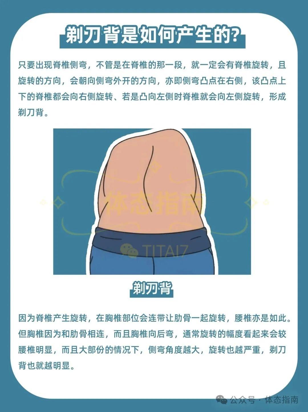 【剃刀背】评估、成因、训练思路 - 知乎