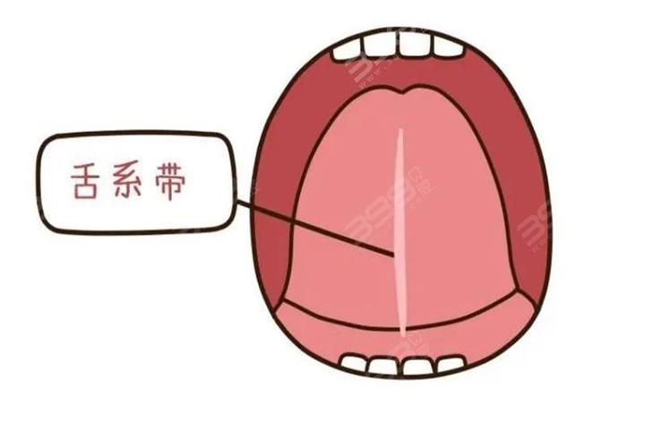 孩子舌筋短要不要剪？宝宝发音不清楚就剪舌系带，白挨了 - 知乎