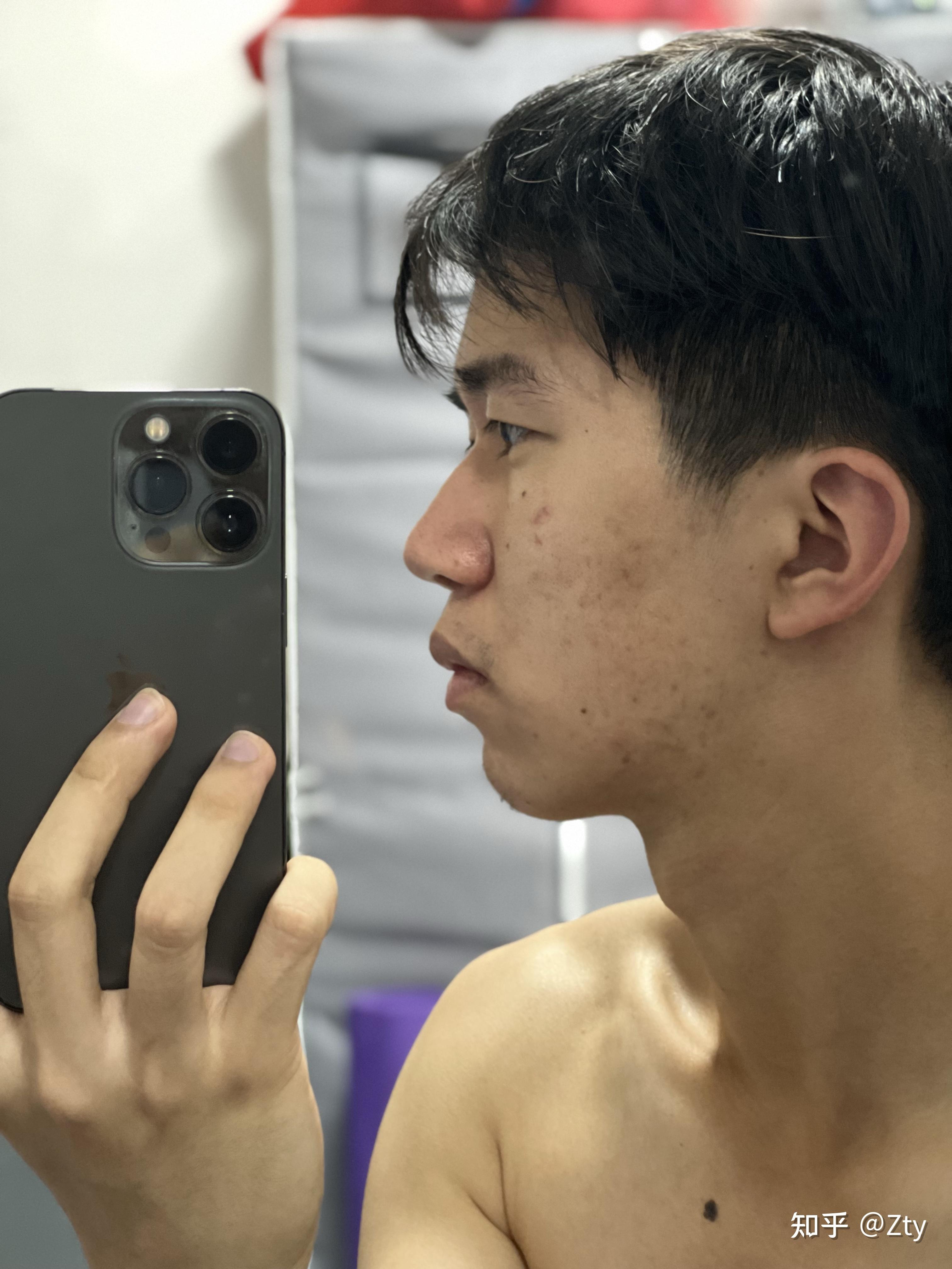 正脸正常,侧脸丑到爆是什么体验? - 知乎