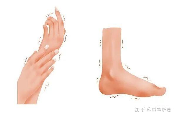 总感觉手麻、腿麻?警惕是这5种疾病的暗示! - 知乎