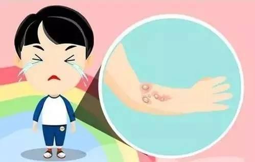 疤痕疙瘩刺痒要怎么办