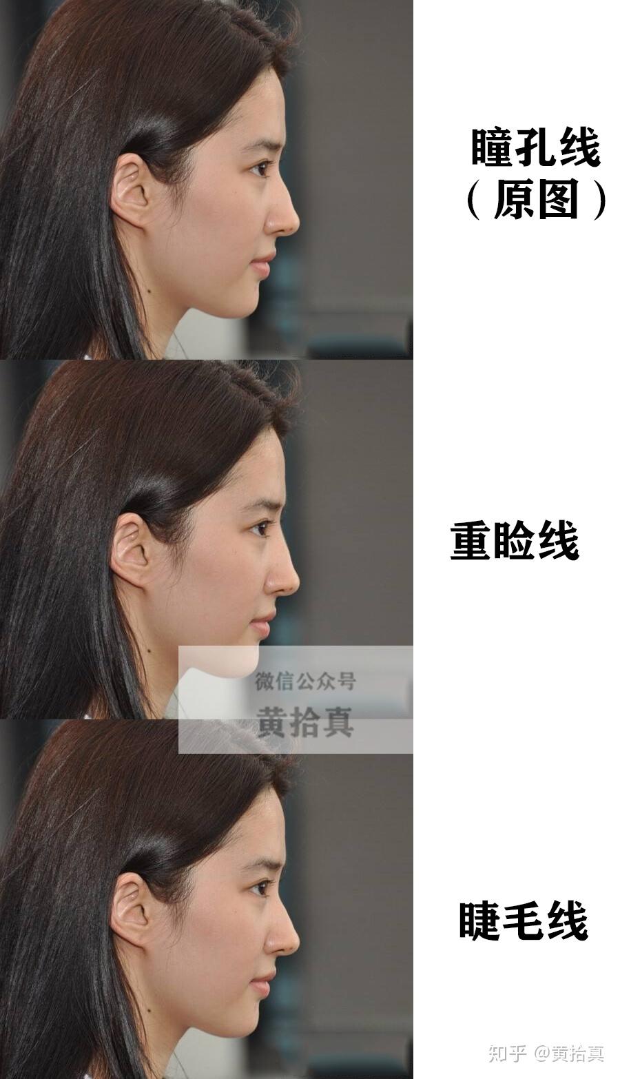 山根低鼻梁高是怎样的体验