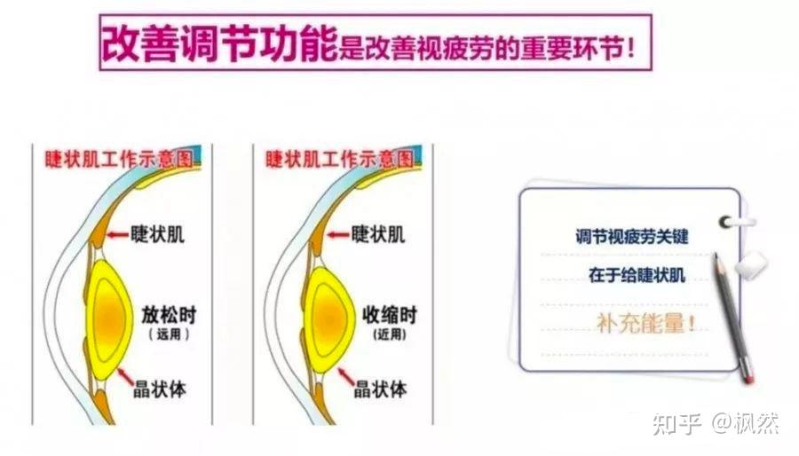眼干眼胀畏光流泪，眼疲劳，如何才能缓解？改善眼调节才是关键！ - 知乎