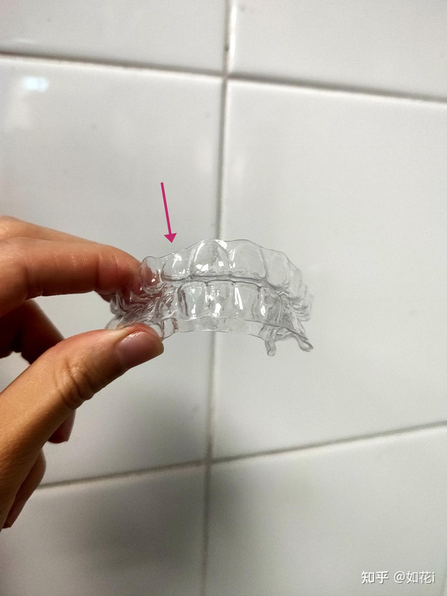 我的保持器又断了,一副保持器寿命是多长呢? - 知乎