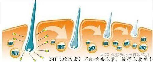 3分钟自测发际线高低,你是几指? - 知乎