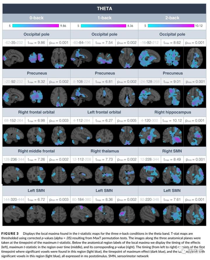 Human Brain Mapping:多项目工作记忆的时空和波谱动态特性—基于MEG的