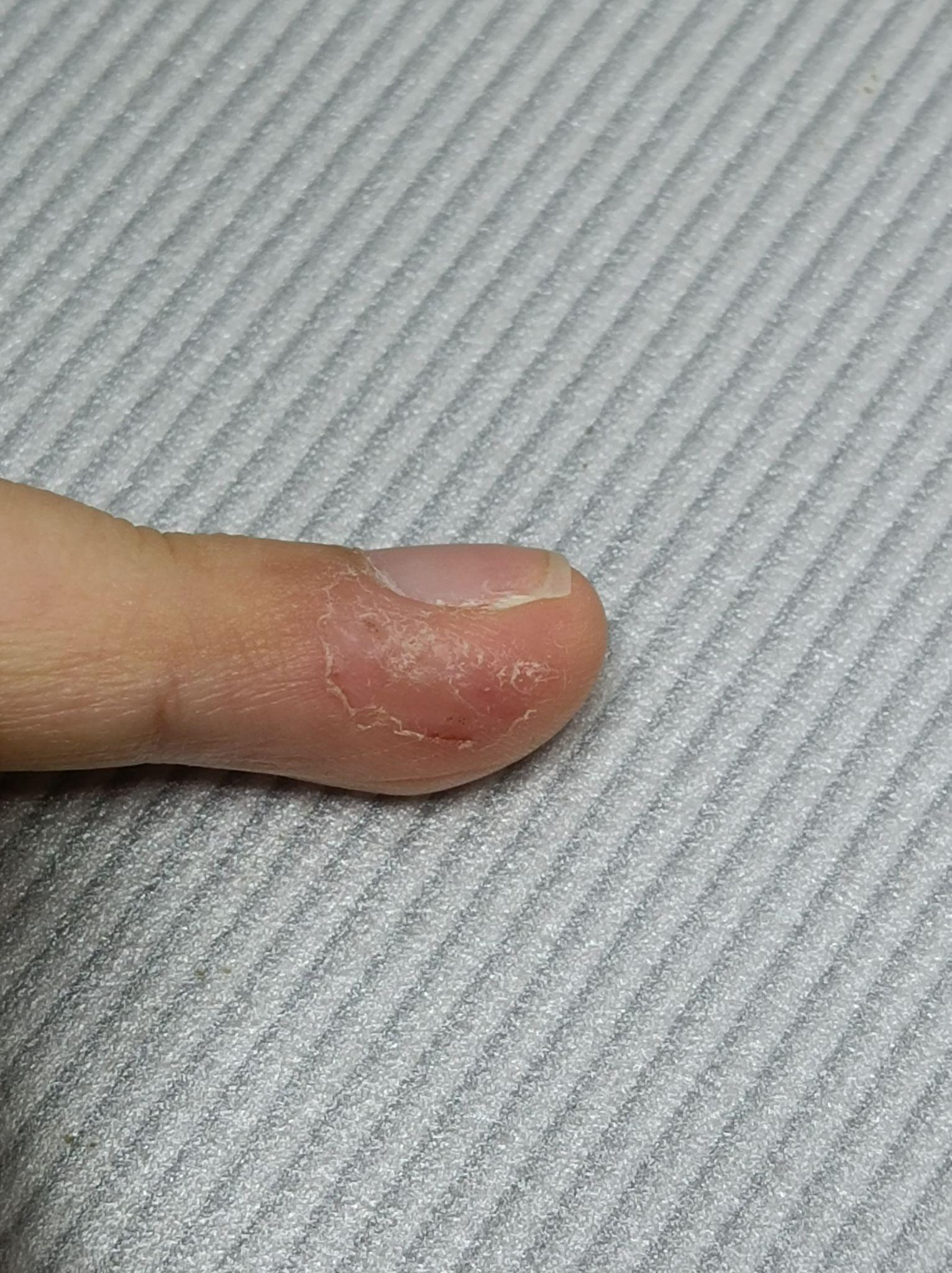 有喜欢抠指甲旁边的皮的吗? - 知乎