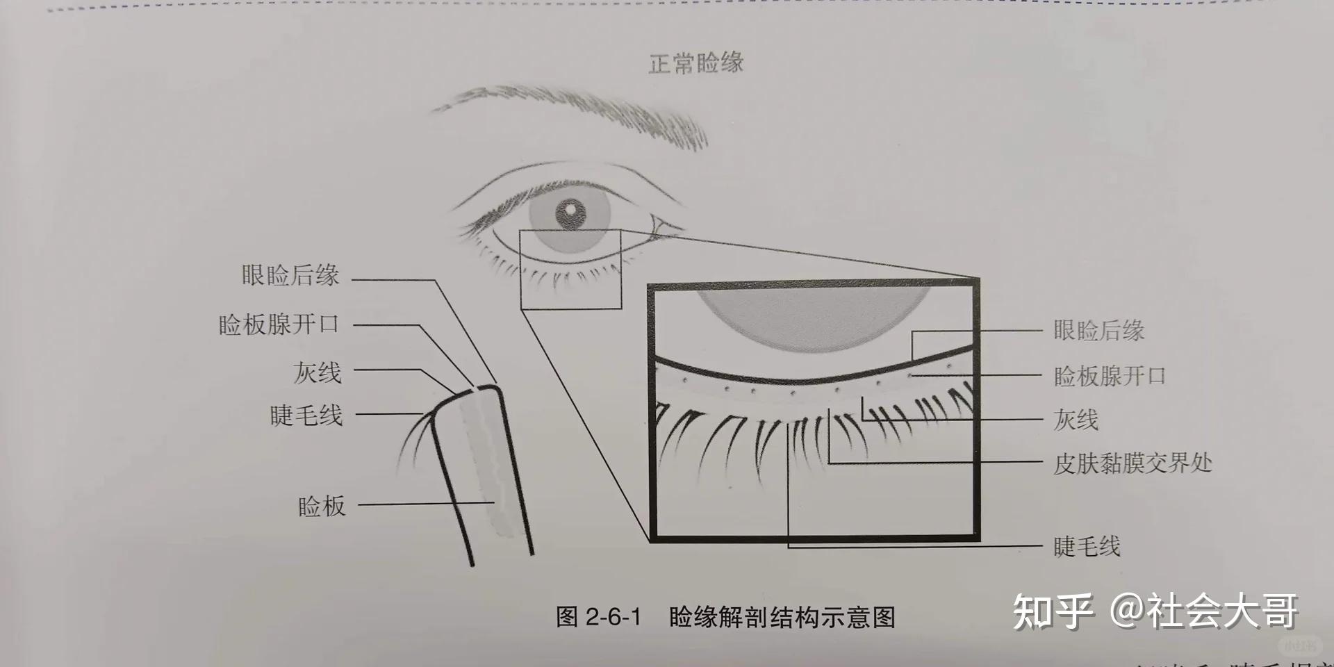 你真的了解干眼？一文带你了解干眼中睑板腺 - 知乎