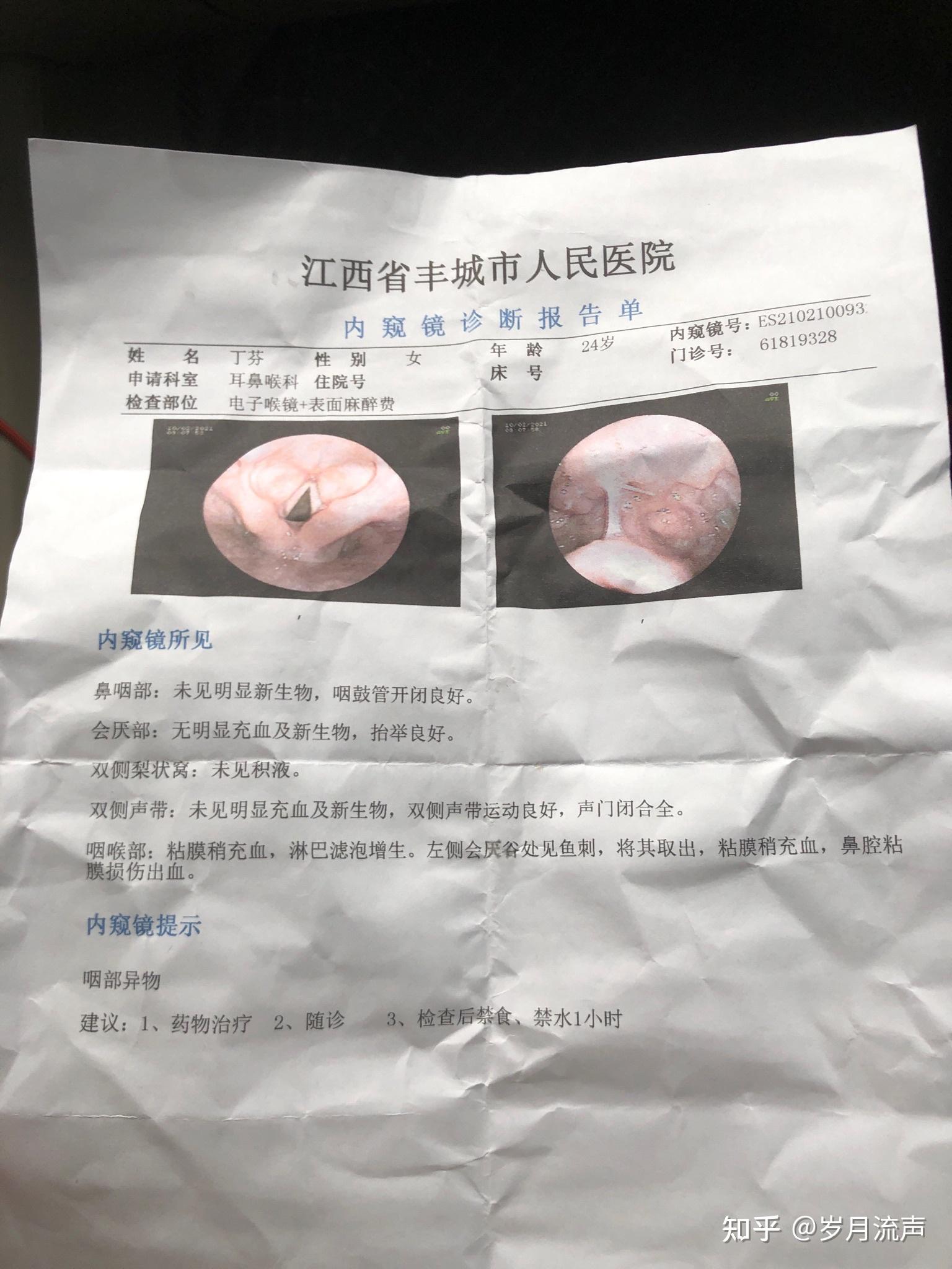 做过喉镜的人能来说下吗你们做的时候难受吗什么感觉