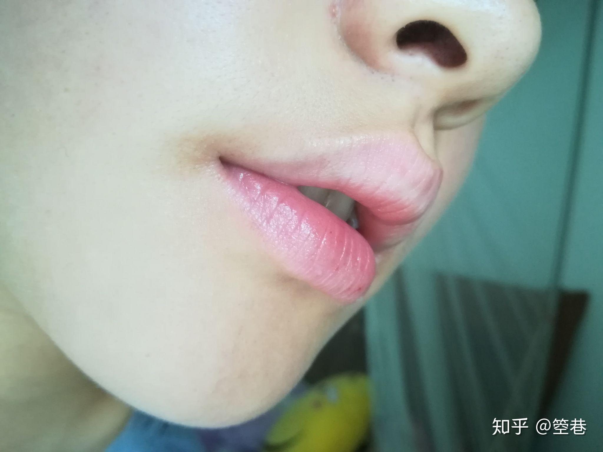 大家有没有常年嘴唇起皮根本无法上口红的