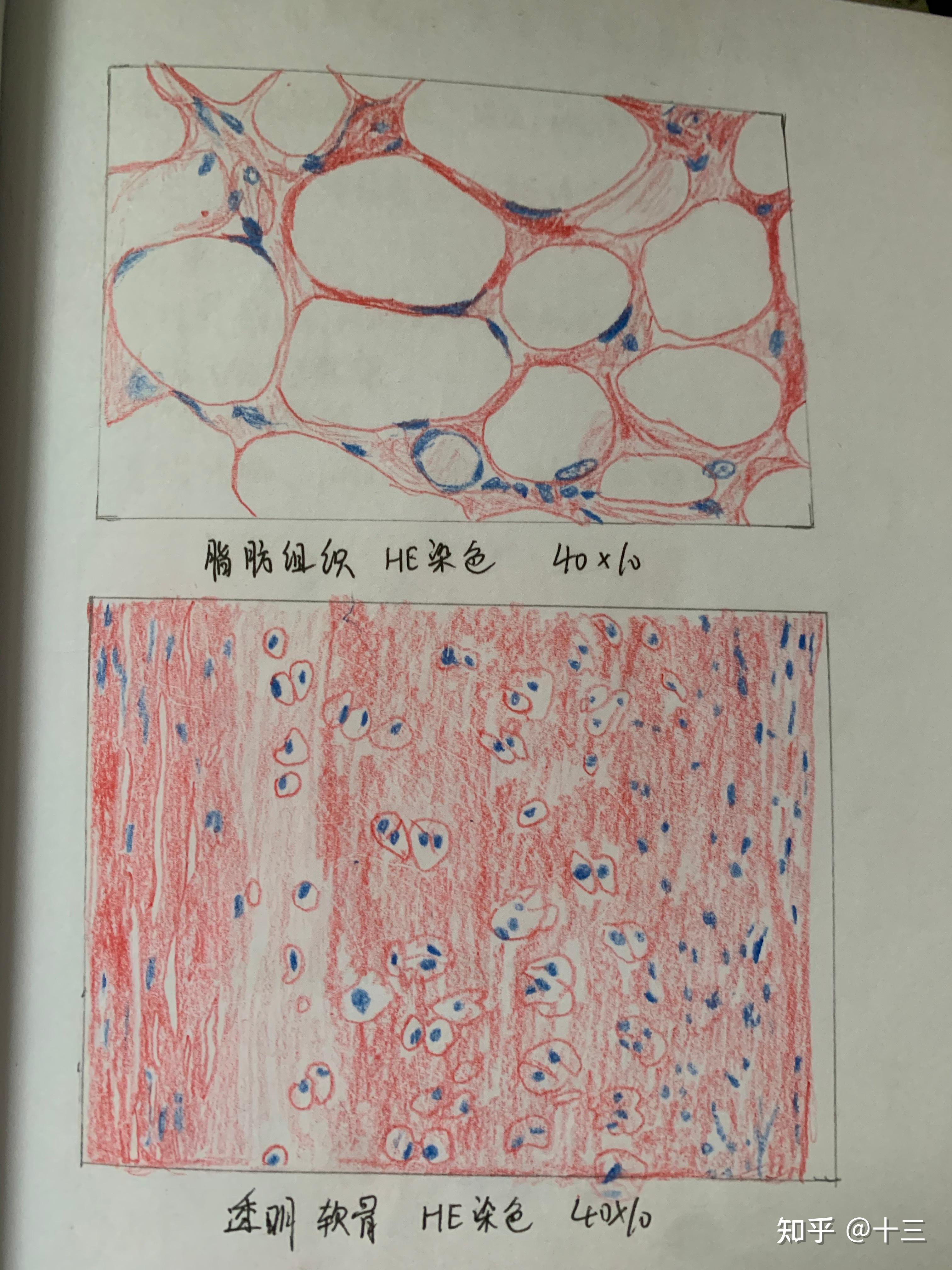 疏松结缔组织绘画图图片