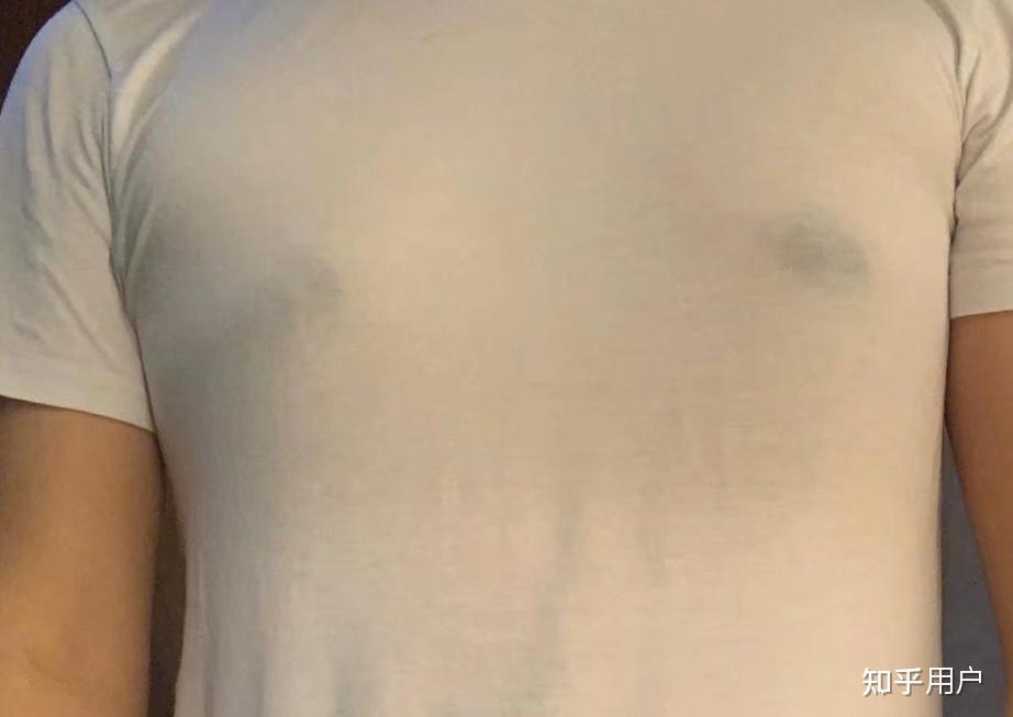 二十几岁的男性 乳头突出 夏天穿衣服胸前两个突出 只能时刻注意 把
