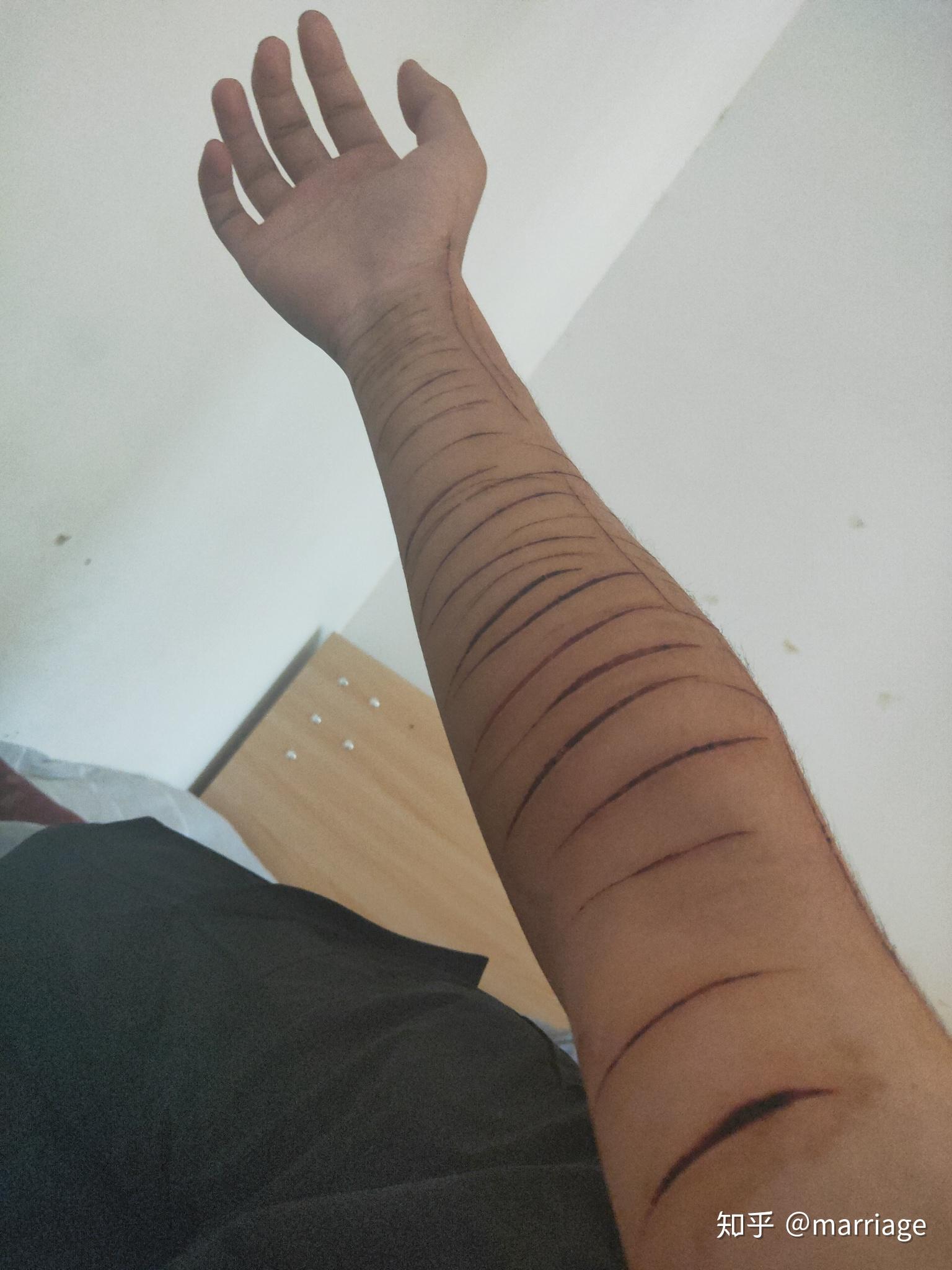 以前自残了别人会问怎么弄的为什么弄如何不尴尬的回答