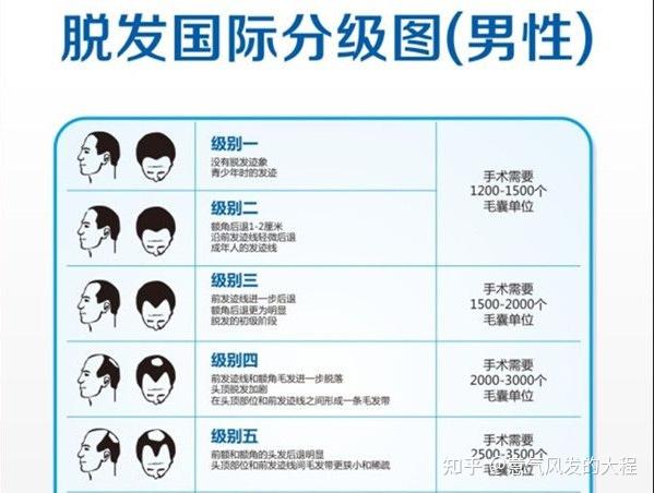 做植发要多少钱，为啥有人花10万有人花几千？植发价格该怎么算 - 知乎