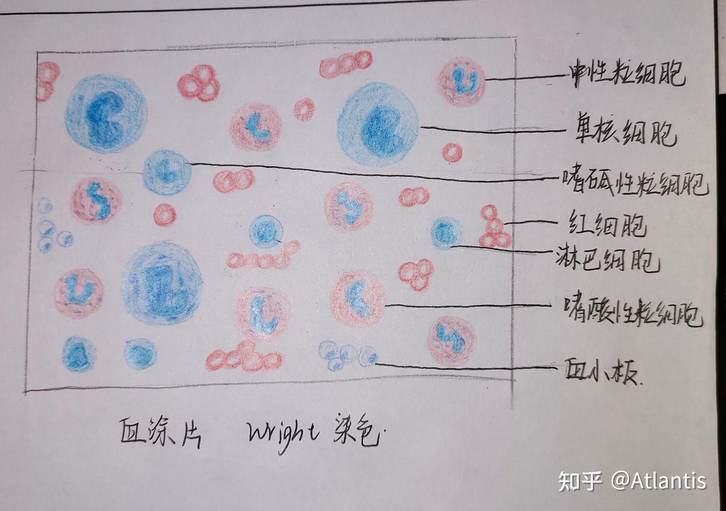 有沒有紅藍鉛筆血塗片的手繪圖? - 知乎