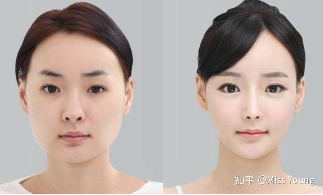 整容的极限是什么? - 知乎