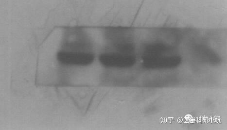 western blot 内参不齐该如何改进呢? - 知乎