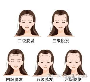 发缝变宽，还有办法补救吗？ - 知乎