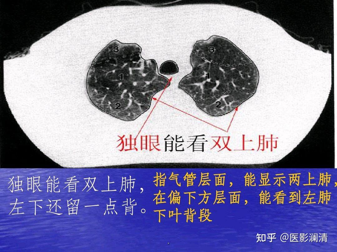 人体五片肺叶大小顺序图片