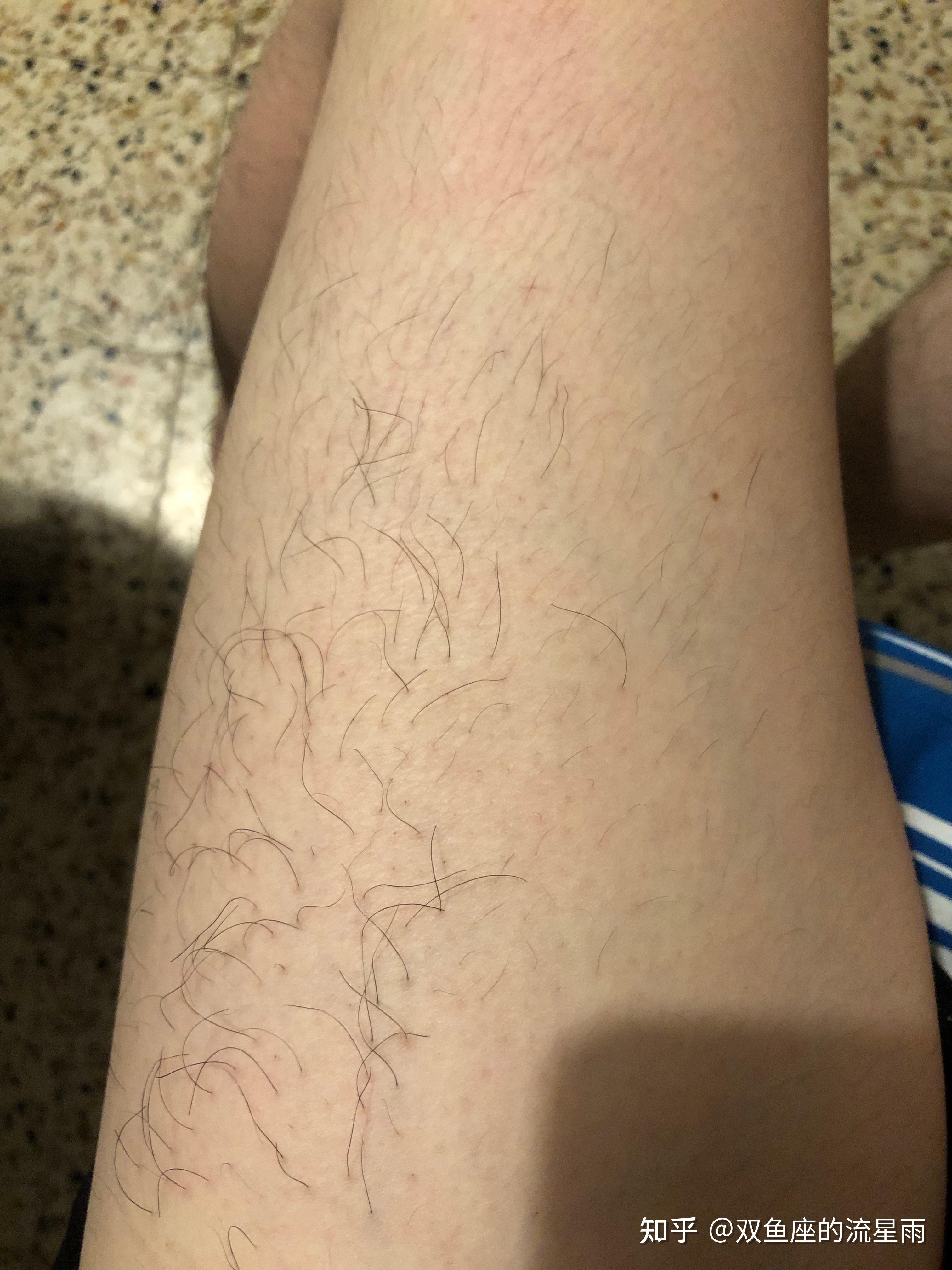 腿毛直接连根拔起后会再长吗?长的话,会变密变粗吗? - 知乎