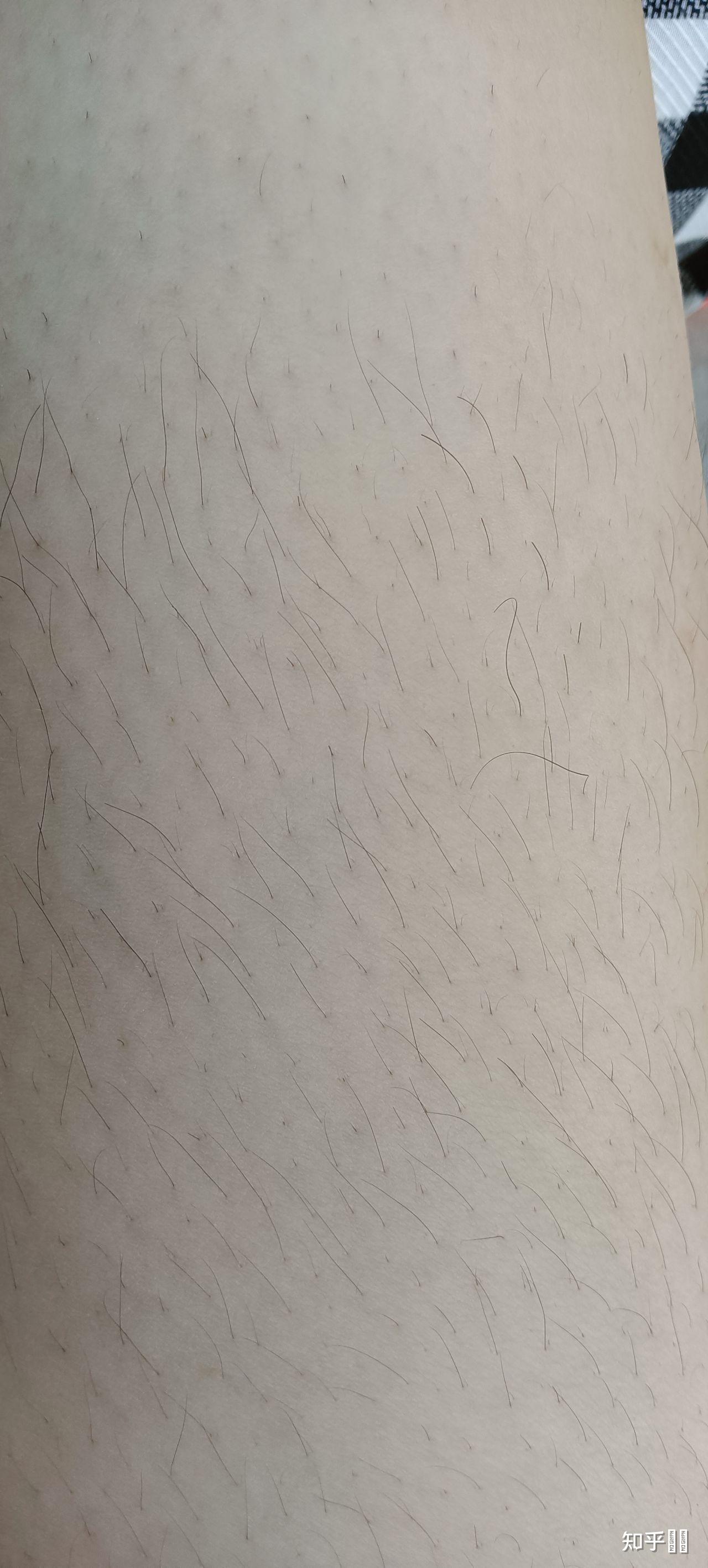 女生的腿毛究竟有多长