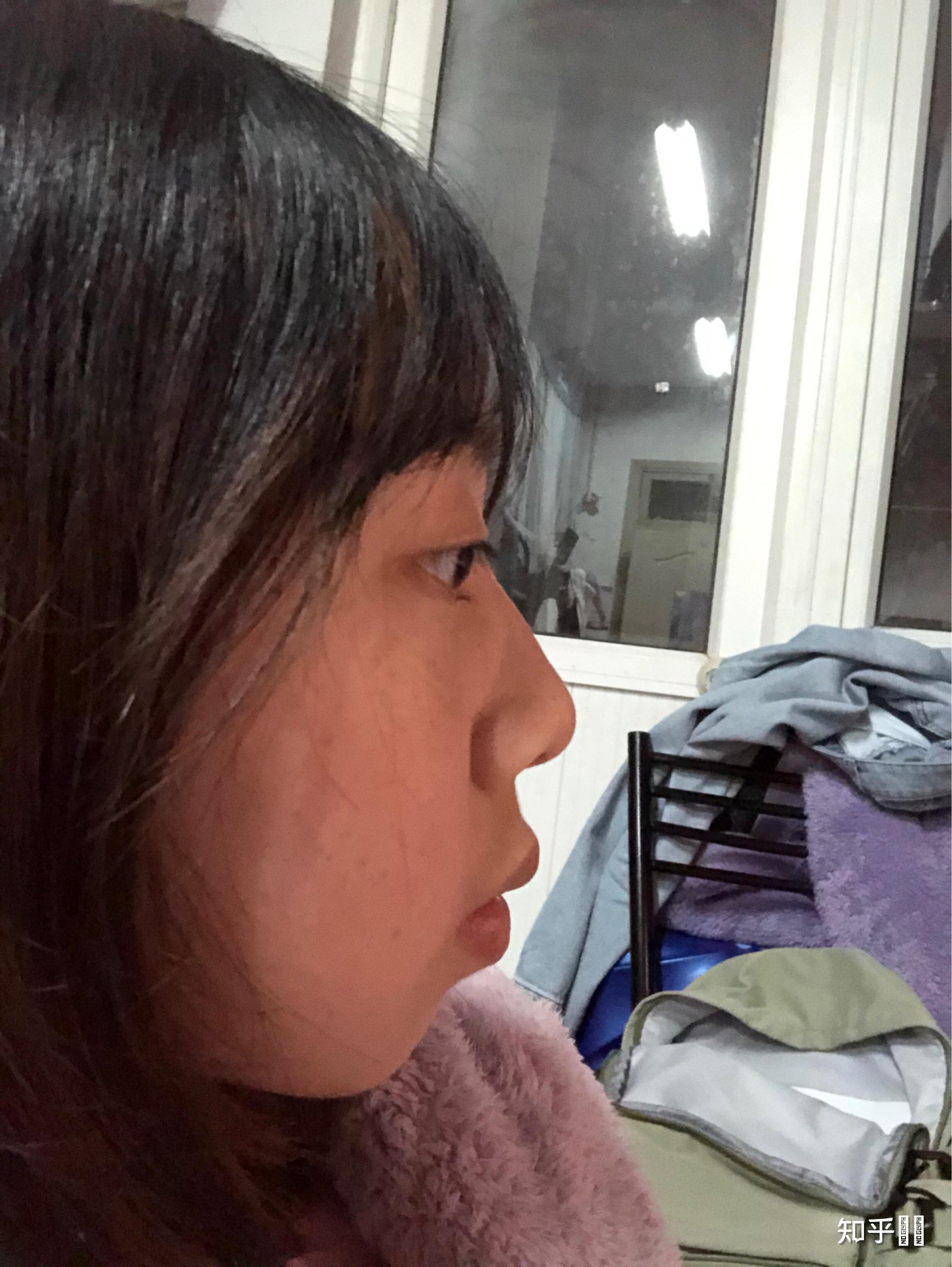 嘴巴凸应该怎么办啊啊啊?