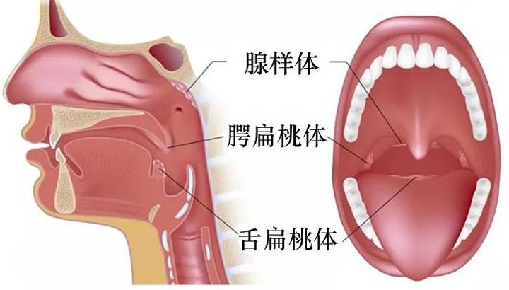 扁桃体是哪个位置图片