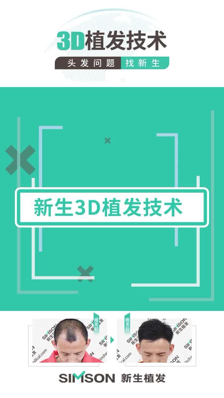 关于植发费用新生3d植发专业的信息